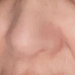 Deep Pore Blackhead Removal Nose Strips photo review