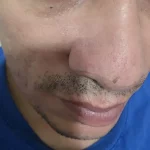 Deep Pore Blackhead Removal Nose Strips photo review